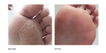 Peeling Skin Formula 125ml by Footlogix